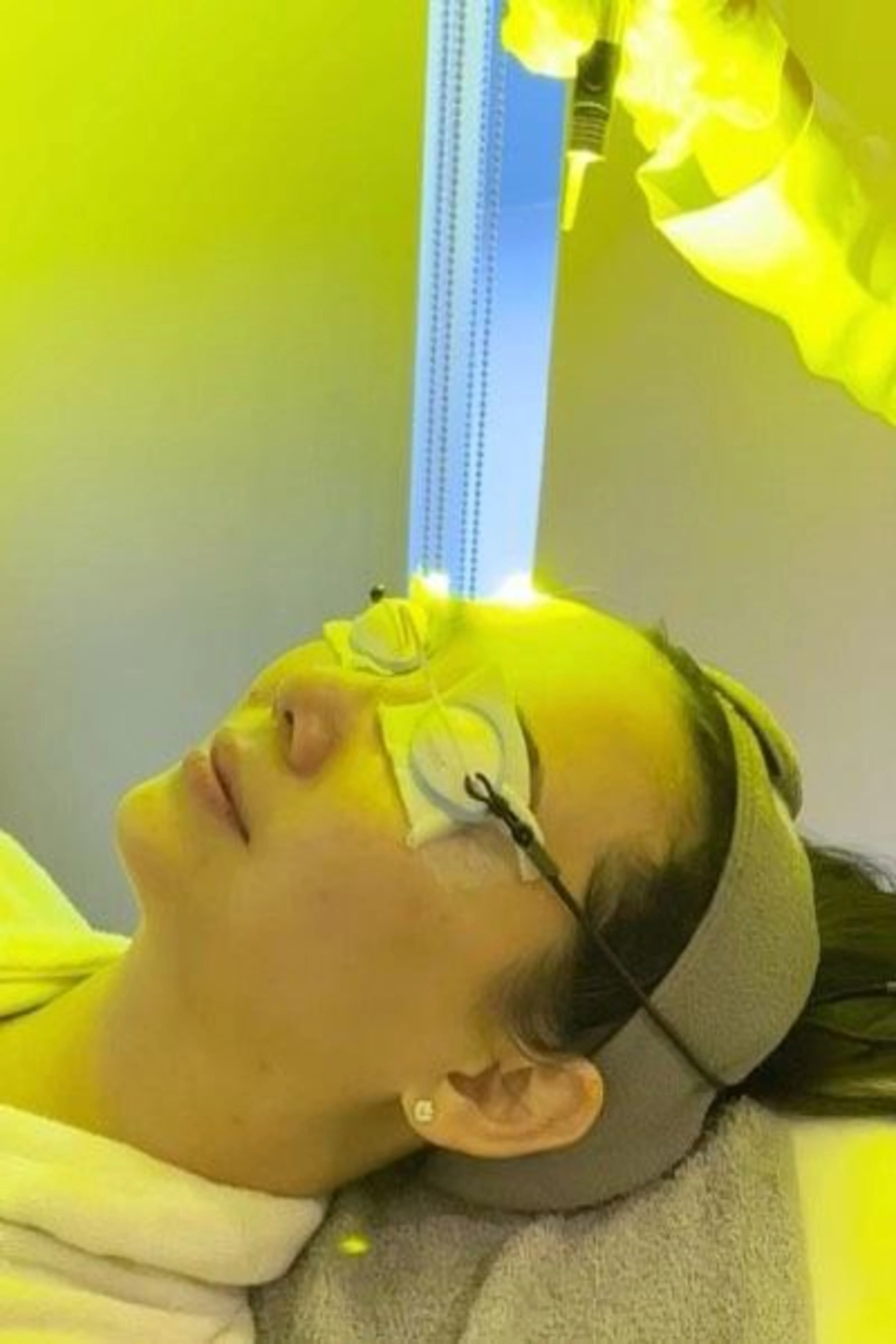 Laser Procedures