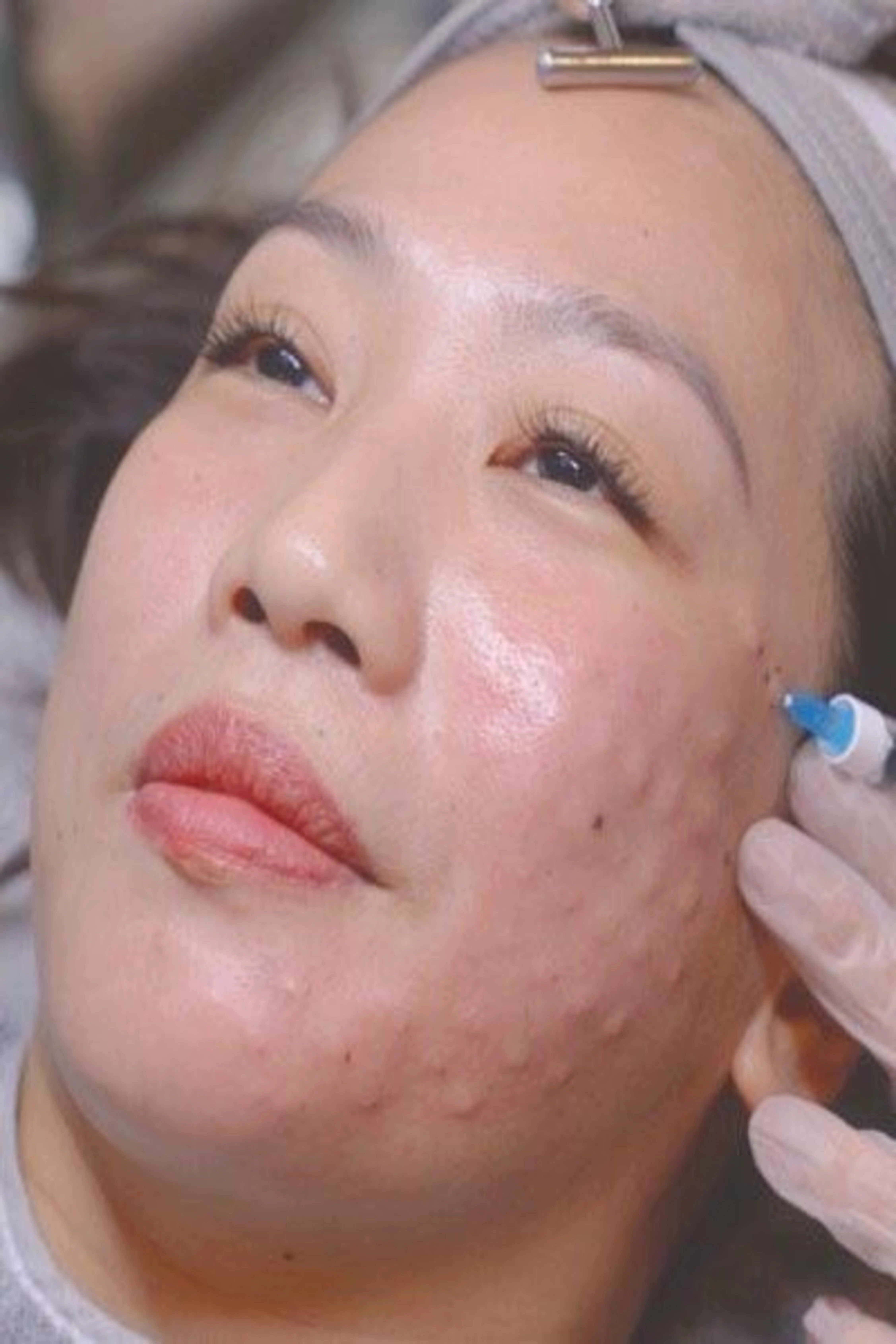 Revitacell